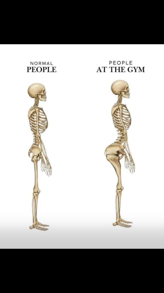 When you see X-rays: left is "Normal People" and right is "People at the Gym" with those massive glutes. #fitness #gym.