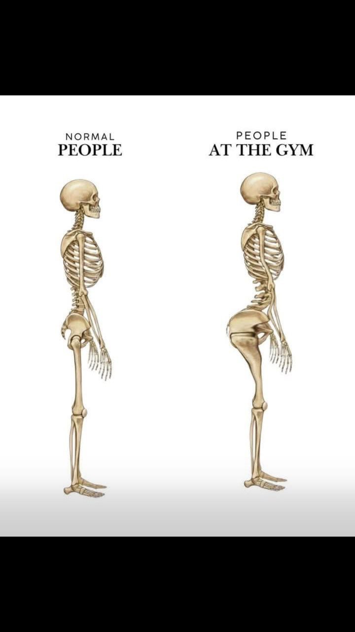 When you see X-rays: left is "Normal People" and right is "People at the Gym" with those massive glutes. #fitness #gym.