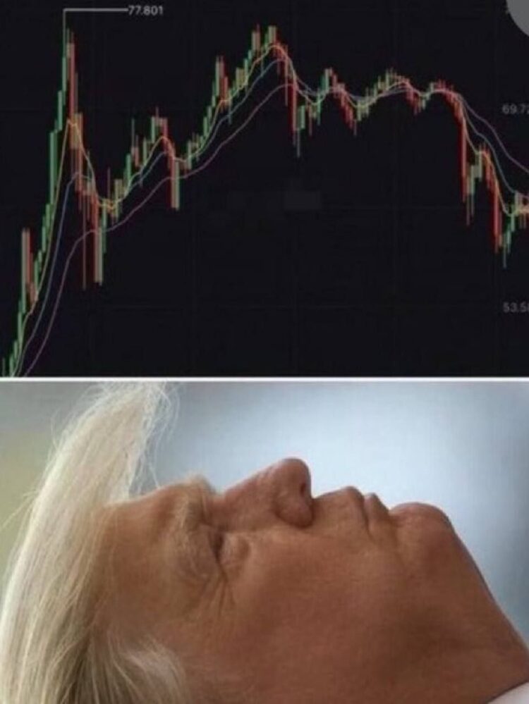 When your portfolio tanks but at least your hair matches the stock chart vibes #relatable #stonks.