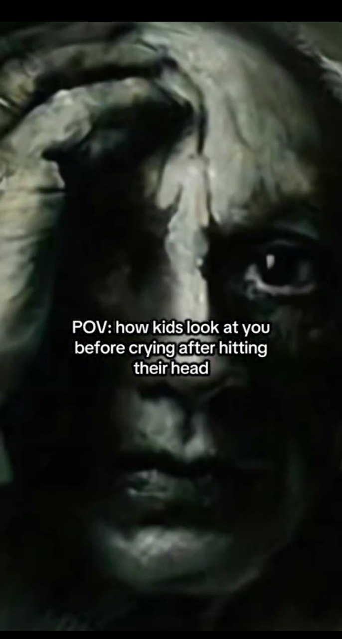 That look kids give you right before they explode into tears after bumping their head. POV: how kids look at you before crying #relatable.