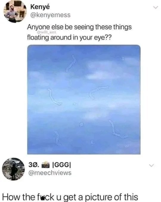 Anyone else be seeing these things floating around in your eye?? How the f*** u get a picture of this? #mood #wtf.